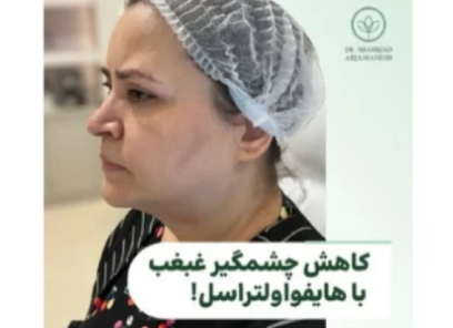 رفع غبغب | رفع غب غب | دکتر شهرزاد آریامنش